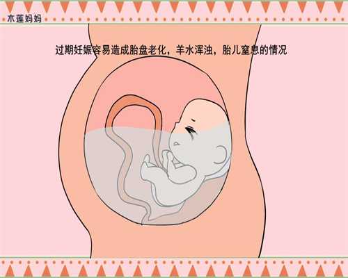 上海国内靠谱代孕_上海怎么借腹生子不违法_孕妇腰痛怎么缓解 这些小方法学起